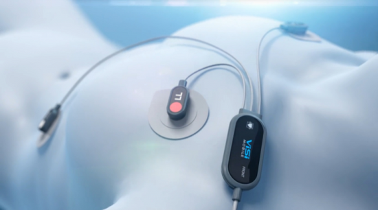 松下研發可穿戴設備“微電池”  明年2月量產并上市